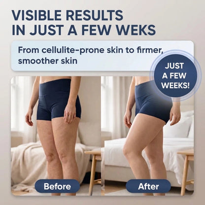 Steplabb ReliefCup™ - Firmer, More Toned Skin
